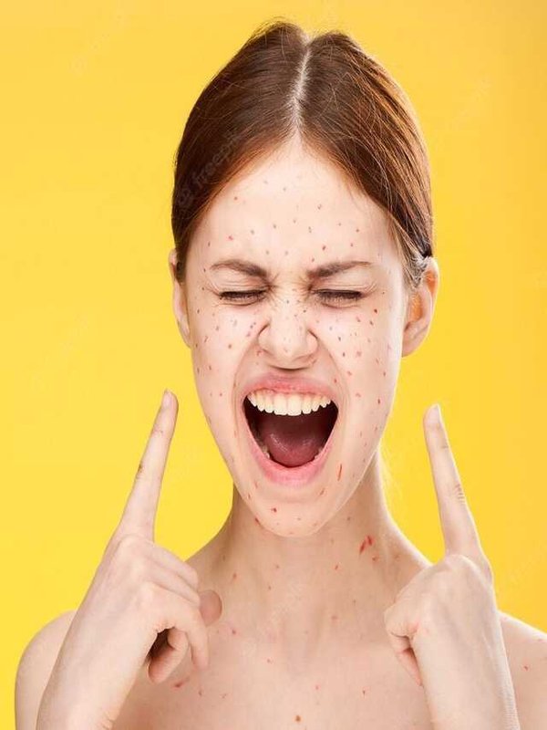 BIRTH MARK CAN REVEALED HUMAN BEHAVIOUR