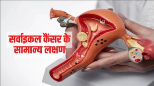 Cervical cancer Vaccine, Cervical cancer symptoms, Cervical cancer causes,