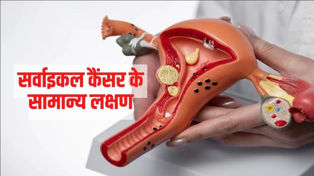 Cervical cancer Vaccine, Cervical cancer symptoms, Cervical cancer causes,