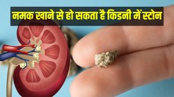 Kidney Stone: यूरिन में कैल्शियम बढ़ने से हो सकता है किडनी स्टोन, गलती से भी न खाएं इन फूड्स के साथ नमक