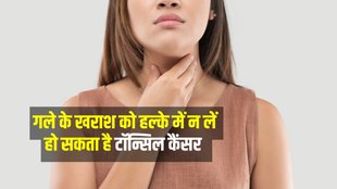 Tonsil Cancer symtomps, Tonsil Cancer Treatment, Tonsil Cancer Causes