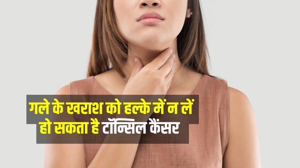 Tonsil Cancer symtomps, Tonsil Cancer Treatment, Tonsil Cancer Causes