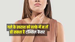 Tonsil Cancer: गले की खराश को हल्के में न लें, हो सकता है टॉन्सिल कैंसर; ये लक्षण दिखे तो हो जाए सावधान