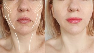 Wrinkles on face, wrinkles on face remedy, wrinkles on face at young age