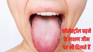 high cholesterol symptoms in tongue, tongue color may signal high cholesterol