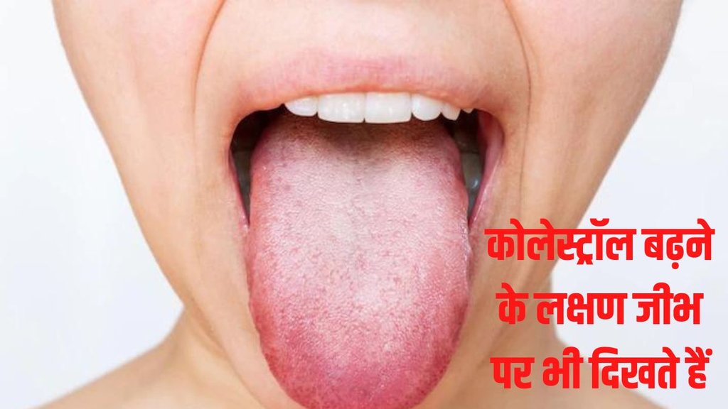 high cholesterol symptoms in tongue, tongue color may signal high cholesterol