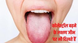 Cholesterol control: जीभ पर दिखने वाले ये निशान हाई कोलेस्ट्रॉल होने के देते हैं संकेत, जानिए कैसे