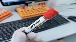 पेट में जाते ही LDL Cholesterol बढ़ाते हैं ये 5 लिक्विड फूड्स, कभी भी हो सकता है Heart Attack