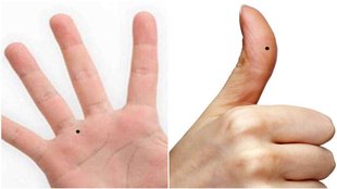 mole in hand, lucky mole in hand