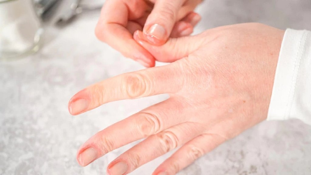 brittle nails, white spots on nail,