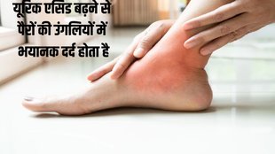 uric acid build up,Uric Acid,reduce high uric acid levels,kidney stones,