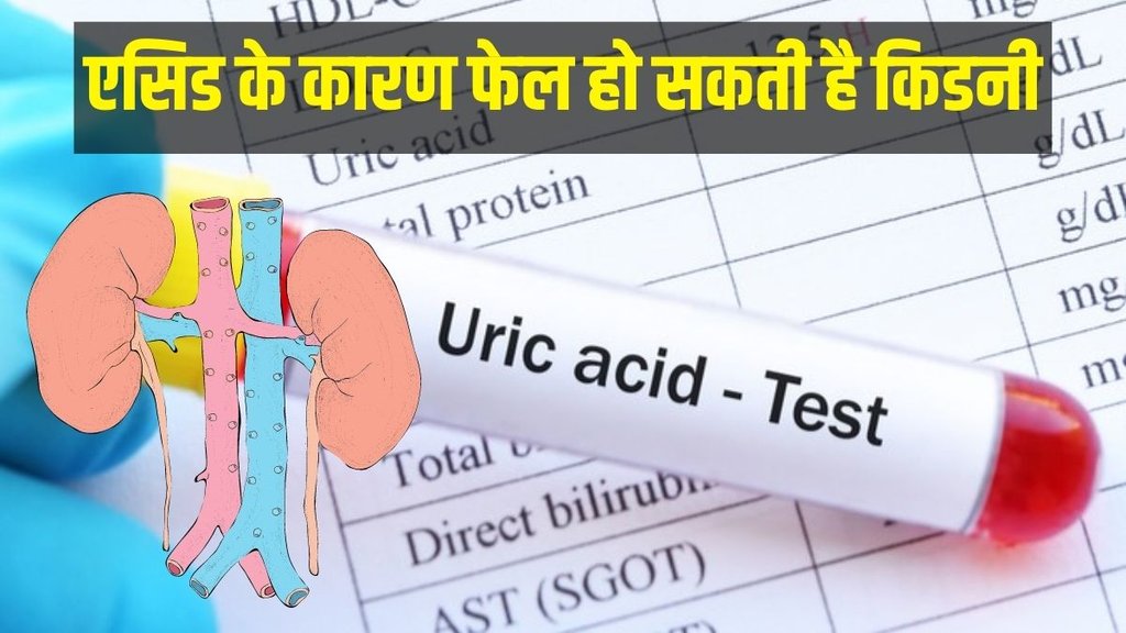 Uric Acid Control, Uric Acid, Uric Acid Remedies