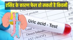 एसिड के कारण फेल हो सकती है किडनी, भूलकर भी इन 5 फूड्स को न करें सेवन