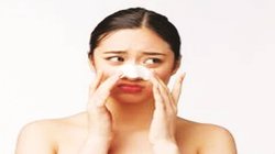 मुंहासे की समस्या ताकि छिपाना न पड़े चेहरा