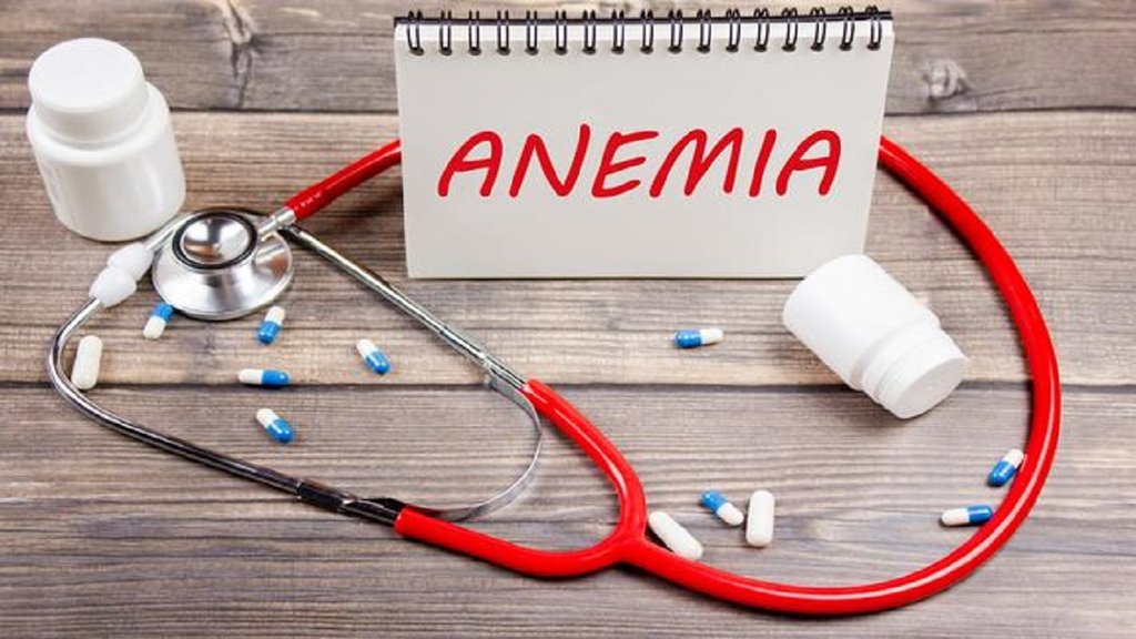 Anemia Deficiency: स्किन का पीला होना, चक्कर आना और सांस लेने में दिक्कत होना एनीमिया के लक्षण हैं। PHOTO-FREEPIK