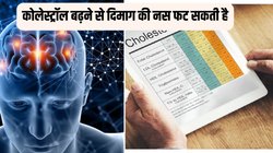 कोलेस्ट्रॉल का स्तर 160 mg/dL से 189 mg/dL तक पहुंचने पर फट सकती है दिमाग की नस,जानिए ब्रेन हैमरेज से बचाव करने के लिए कैसे करें कोलेस्ट्रॉल कंट्रोल