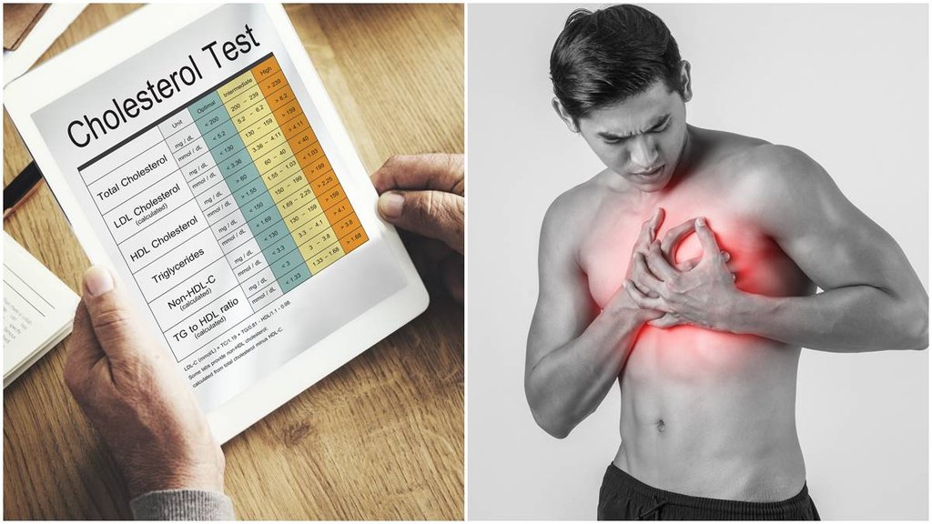 cholesterol | bad cholesterol | LDL cholesterol
