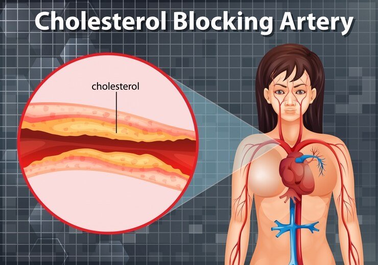 foods for cleansing intestine dirt, stomach clear