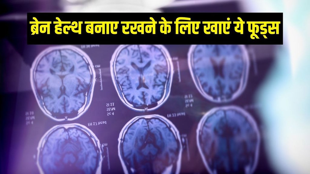 dementia | dimentia symptoms | lewy body dementia