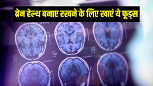 dementia | dimentia symptoms | lewy body dementia