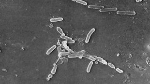 US Centers for Disease Control and Prevention| electron microscope image| Pseudomonas aeruginosa bacteria