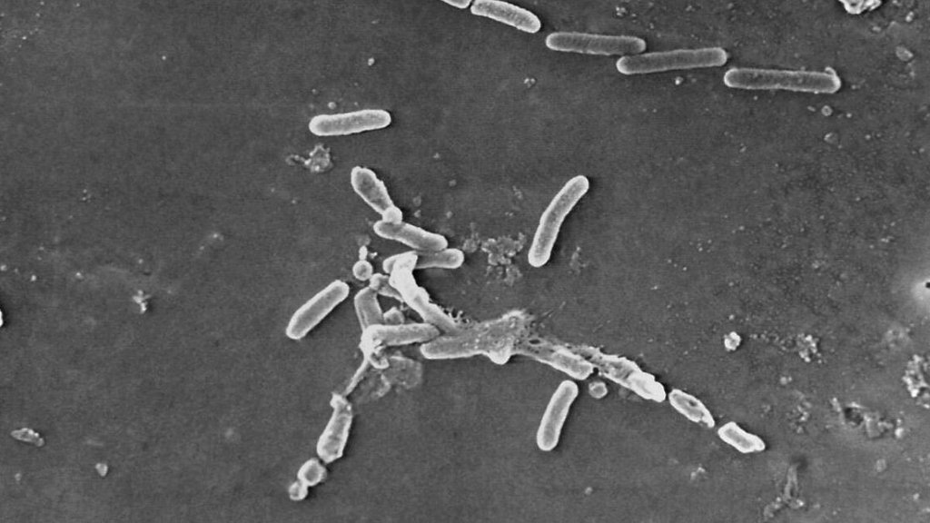 US Centers for Disease Control and Prevention| electron microscope image| Pseudomonas aeruginosa bacteria