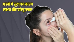 eye dryness, eye dryness treatment, dryness