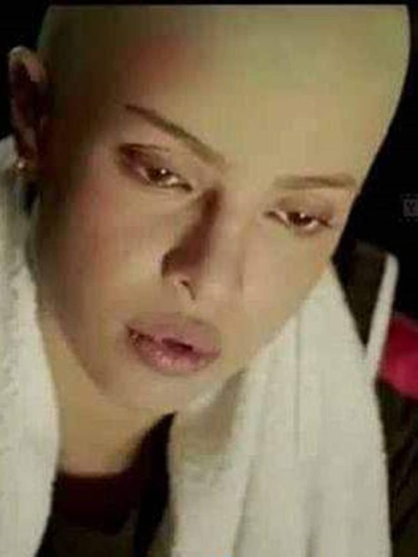 ACTRESS IN BALD LOOK