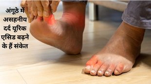 Minter Water,Uric Acid,Minter Water For Uric Acid,How to Reduce Uric Acid,