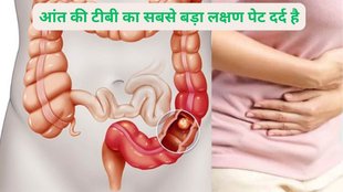health tips, healthy lifestyle, world TB day 2023, TB symptoms, TB myths