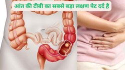आंत में कुडली मारकर खोखला कर सकता है टीबी का बैक्टीरिया, एक्सपर्ट ने बताया ऐसे रखेंगे ख्याल तो पहले पता लग जाएगी बीमारी