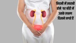 Kidney Cure: किडनी में परेशानी होने पर बॉडी में दिखते हैं ये 4 वॉर्निंग साइन, जानिए कैसे करें लक्षणों की पहचान और बचाव