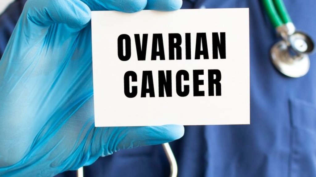 myths about ovarian cancer, misconceptions about ovarian cancer,