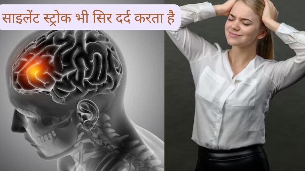 What is silent stroke, when silent stroke occurs, causes of silent stroke