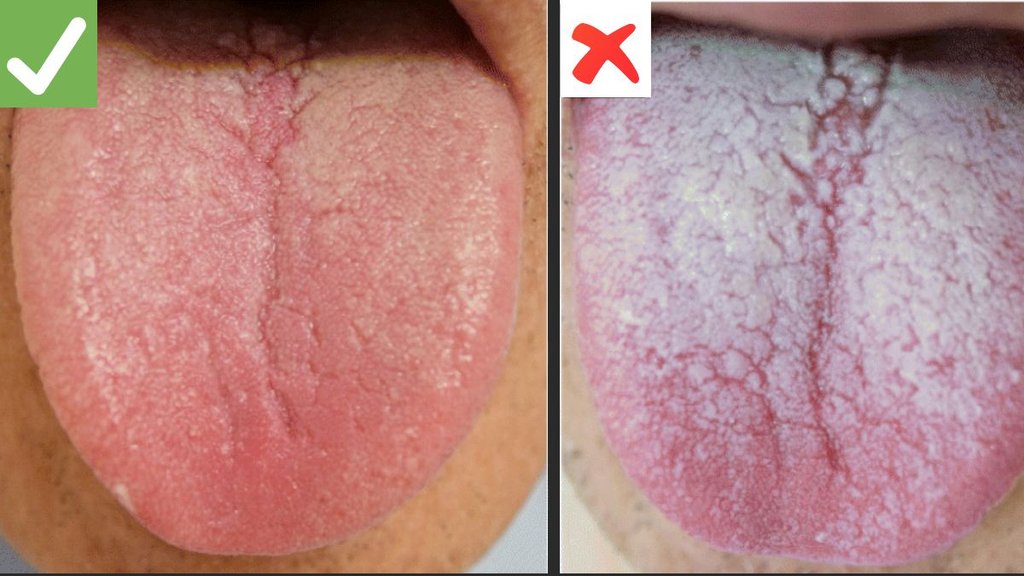 Health, Fitness, Lifestyle