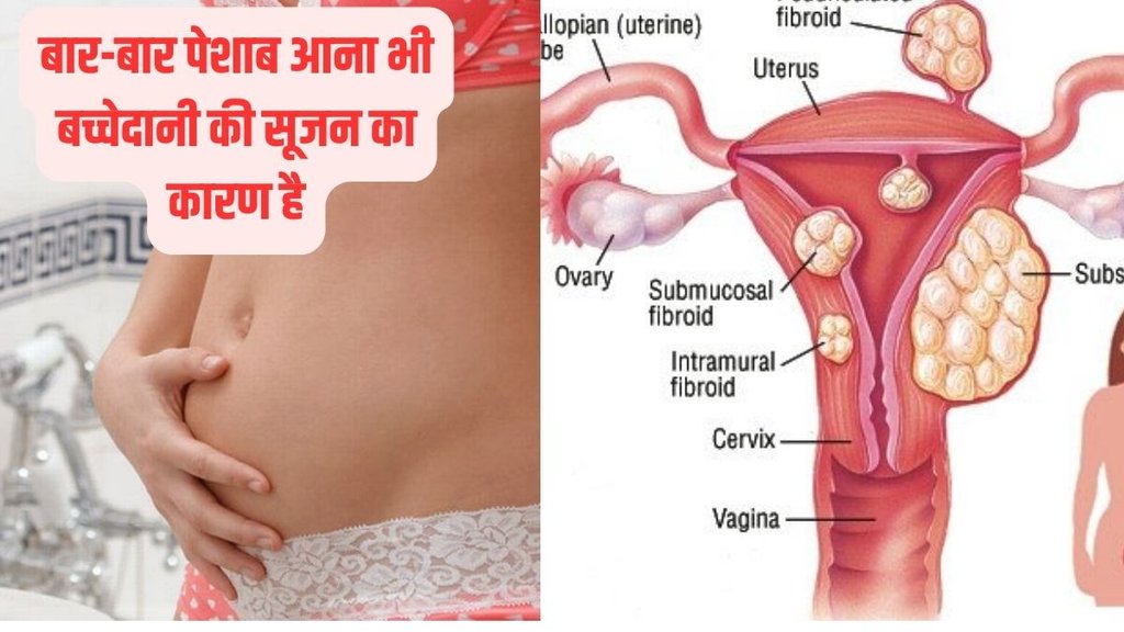 bachedani me sujan, bachedani me sujan ke lakshan in hindi, bachedani me sujan kyu aati hai, bachedani me sujan ka gharelu ilaj