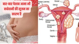 bachedani me sujan, bachedani me sujan ke lakshan in hindi, bachedani me sujan kyu aati hai, bachedani me sujan ka gharelu ilaj