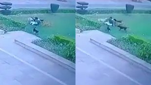 AMU Dog| AMU Dog Bite| AMU Dog Bite Viral Video|