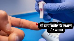 prediabetes causes, prediabetes symptoms, prediabetes treatment, impaired glucose tolerance in hindi, प्री डायबिटीज के लक्षण, कारण और उपचार