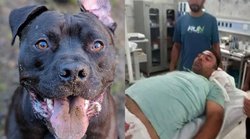 पिट बुल डॉग ने कर दिया व्यक्ति के प्राइवेट पार्ट पर हमला, मुश्किल से बची जान; भड़के लोग कर रहे ऐसी मांग