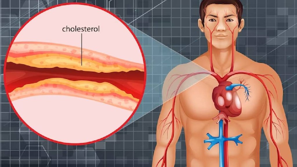 Garlic is helpful in reducing cholesterol,garlic benefits,लहसुन कोलेस्ट्रोल को करता है कंट्रोल, bad cholesterol
