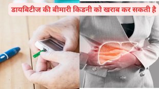 diabetic nephropathy,Swelling of the hands, ankles, or feet,Dry skin and itchiness​,Urine has protein traces,​​Change in appetite​,