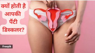 Panty discoloration, Acidic discharge and underwear stains, White discharge and panty bleaching, Leucorrhoea and panty stains, Vaginal secretions and underwear discoloration