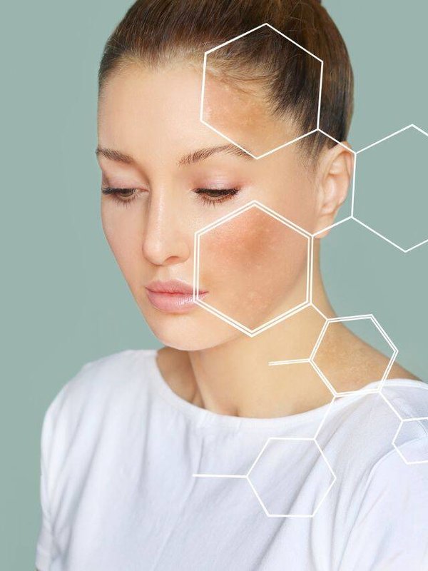 ब्लीच त्वचा