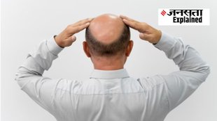 hair fall, men hair loss, male pattern hair loss