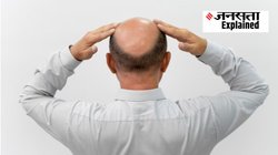 Male Pattern Baldness: पुरुषों में ये 3 लक्षण दिखें तो समझ लें हो गई है गंजेपन की शुरुआत, डॉक्टर से जानिये Hair Loss की वजह और उपाय