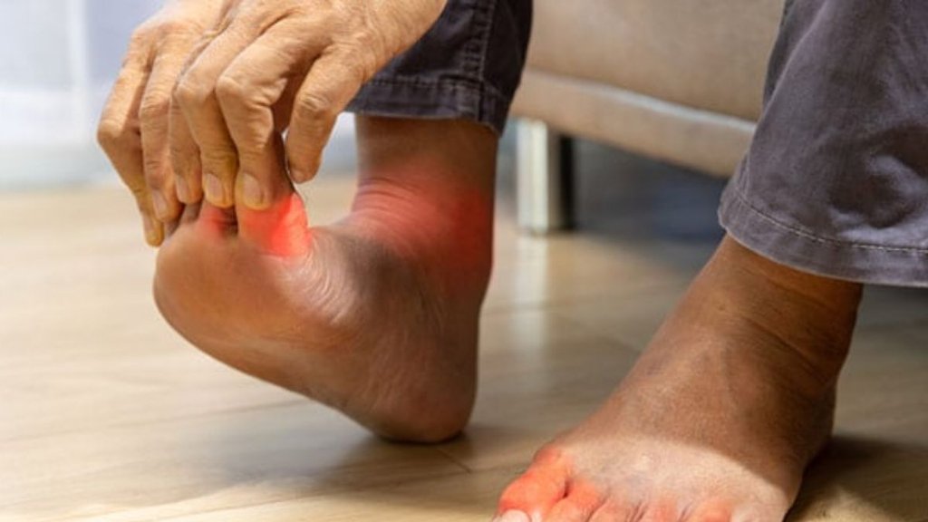 foods increase uric acid, how to control uric acid, high uric acid symptoms in feet,