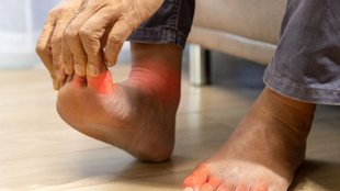 uric acid and joint pain,arthiritis kaise karein theek,joint pan,how to get rid of uric acid pain