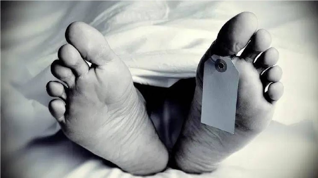 Dead Body