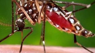 Dengue | fever